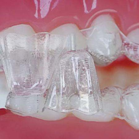 La estabilizaci�n mandibular y la precisi�n articulatoria