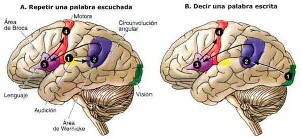 Agnosia auditiva