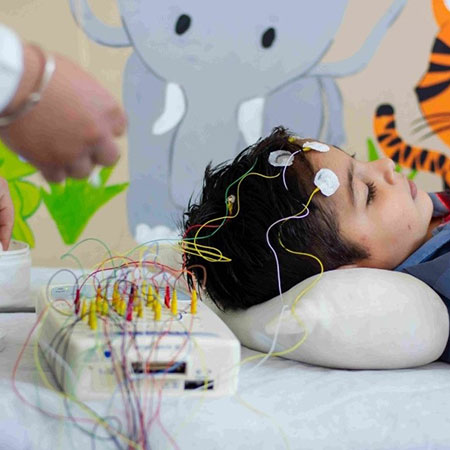 Aprendizaje y epilepsia