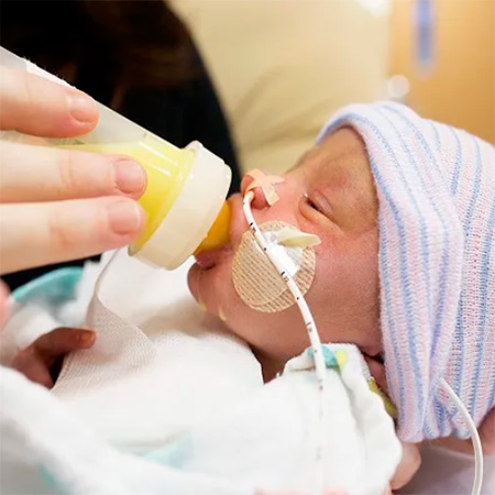 Reflejo de succión en bebés prematuros