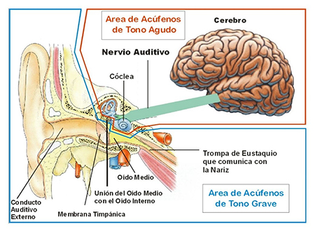 Una metodologa holstica en el tratamiento del acfeno