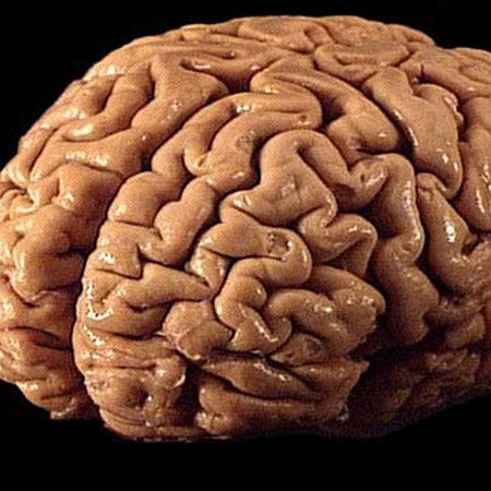 Hemisferios cerebrales