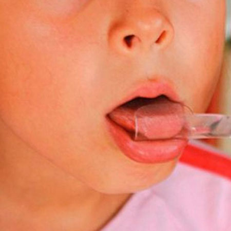 La importancia del tono muscular orofacial