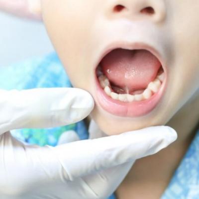 La importancia del tono muscular orofacial